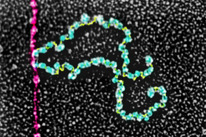 Amino acids and ketoacids offer muscle support in protein-restricted patients